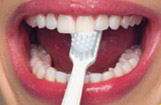 правильный метод чистки зубов