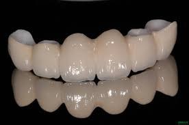 циркониевые керамические зубы